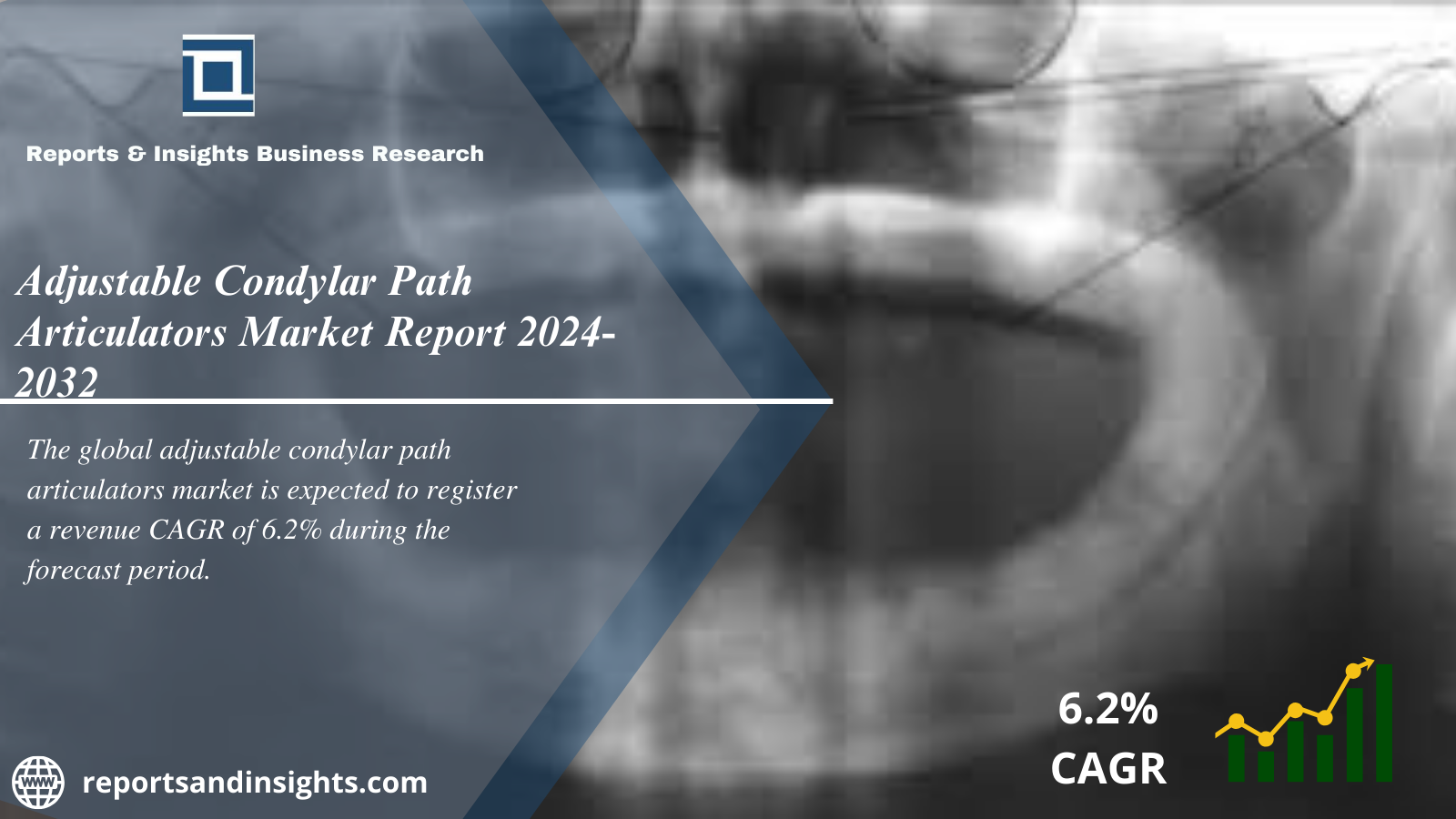 Adjustable Condylar Path Articulators Market Growth, Size, Share, Industry Report and Forecast 2024 to 2032