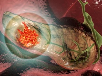 Alfa Cytology Launches Full-Scale Preclinical Services for Pancreatic Cancer Research